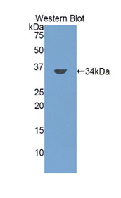 Western Blot; Sample: Recombinant protein.