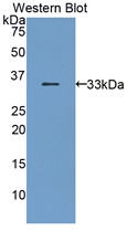 Western Blot; Sample: Recombinant protein.