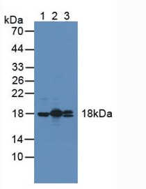Western Blot; Sample: Lane1: Mouse Heart Tissue; Lane2: Rat Heart Tissue; Lane3: Human Hela Cells.