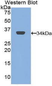 Western Blot; Sample: Recombinant protein.