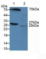 Western Blot; Sample: Lane1: Human Serum; Lane2: Human Urine.