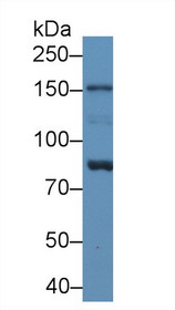 Western Blot; Sample: Human Lung lysate; Primary Ab: 1µg/ml Rabbit Anti-Human NAIP Antibody Second Ab: 0.2µg/mL HRP-Linked Caprine Anti-Rabbit IgG Polyclonal Antibody