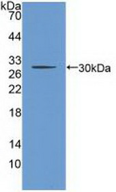 Western Blot; Sample: Recombinant CHRNb2, Human.