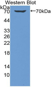 Western Blot; Sample: Recombinant protein.