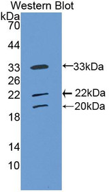 Western Blot; Sample: Recombinant protein.