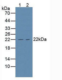 Western Blot; Sample: Lane1: Human Hela Cells; Lane2: Human Jurkat Cells.