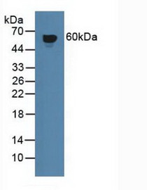 Western Blot; Sample: Human Blood Cells.