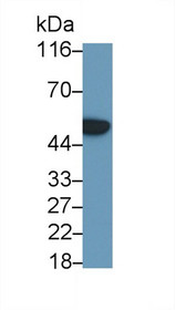 Western Blot; Sample: Recombinant protein.
