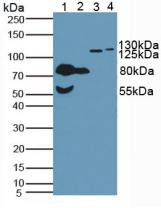Western Blot; Sample: Lane1: Human Serum ; Lane2: Human Urine; Lane3: Porcine Heart Tissue; Lane4: Mouse Heart Tissue.