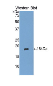 Western Blot; Sample: Recombinant protein.
