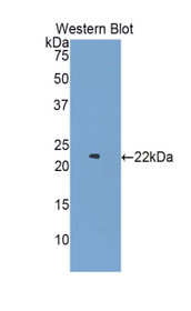 Western Blot; Sample: Recombinant protein.