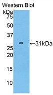 Western Blot; Sample: Recombinant protein.