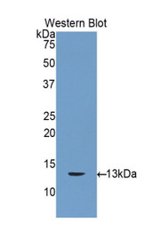 Western Blot; Sample: Recombinant protein.