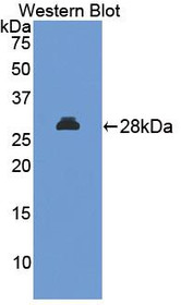 Western Blot; Sample: Recombinant protein.