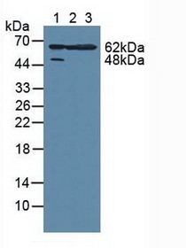 Western Blot; Sample: Lane1: Human Hela Cells; Lane2: Human A549 Cells; Lane3: Mouse Large Intestine Tissue.
