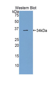 Western Blot; Sample: Recombinant protein.