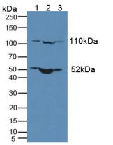 Western Blot; Sample: Lane1: Human Lung Tissue; Lane2: Human MCF-7 Cells; Lane3: Mouse Thymus Tissue.