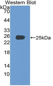 Western Blot; Sample: Recombinant protein.