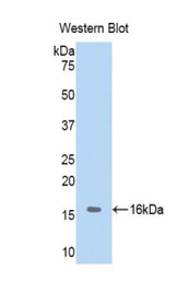 Western Blot; Sample: Recombinant protein.