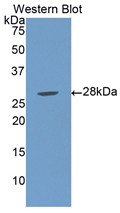 Western Blot; Sample: Recombinant protein.