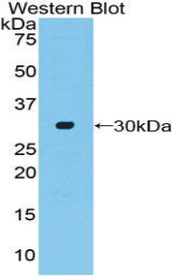 Western Blot; Sample: Recombinant protein.