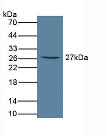 Western Blot; Sample: Rat Serum.