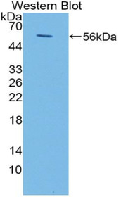 Western Blot; Sample: Recombinant protein.