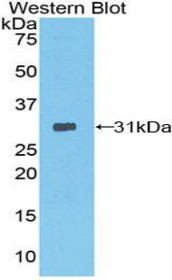 Western Blot; Sample: Recombinant protein.