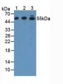 Western Blot; Sample: Lane1: Human SGC7901 Cells; Lane2: Human Hela Cells; Lane3: Rat Stomach Tissue