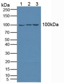 Western Blot; Sample: Lane1: Human Jurkat Cells; Lane2: Human K562 Cells; Lane3: Human Raji Cells.