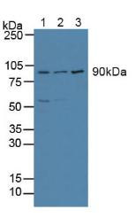 Western Blot; Sample: Lane1: Human Hela Cells; Lane2: Human MCF-7 Cells; Lane3: Human Jurkat Cells.
