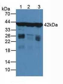 Western Blot; Sample: Lane1: Human Liver Tissue; Lane2: Human Hela Cells.