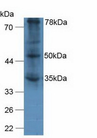Western Blot; Sample: Human A375 Cells.