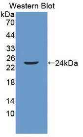 Western Blot; Sample: Recombinant protein.