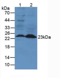 Western Blot; Sample: Lane1: Mouse Lung Tissue; Lane2: Mouse Spleen Tissue.