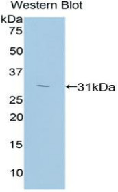 Western Blot; Sample: Recombinant protein.