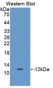 Western Blot; Sample: Recombinant protein.