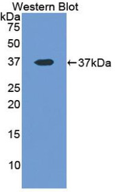 Western Blot; Sample: Recombinant protein.
