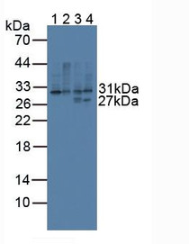 Western Blot; Sample: Lane1: Mouse Spleen Tissue; Lane2: Mouse Thymus Tissue; Lane3: Mouse Lymph Node Tissue; Lane4: Rat Spleen Tissue.