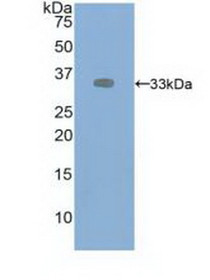 Western Blot; Sample: Recombinant VEGFR2, Human.