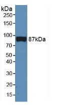 Western Blot; Sample: Rat Serum.