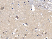 DAB staining on IHC-P; Samples: Human Cerebrum Tissue; Primary Ab: 20µg/ml Rabbit Anti-Human GKRP Antibody Second Ab: 2µg/mL HRP-Linked Caprine Anti-Rabbit IgG Polyclonal Antibody