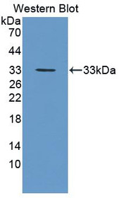 Western Blot; Sample: Recombinant protein.