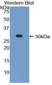 Western Blot; Sample: Recombinant protein.