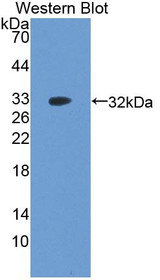Western Blot; Sample: Recombinant protein.