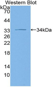 Western Blot; Sample: Recombinant protein.