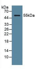 Western Blot; Sample: Human Serum.