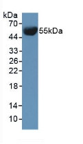 Western Blot; Sample: Mouse Serum.