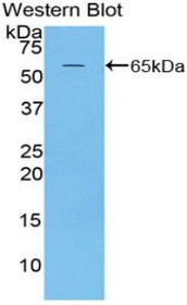 Western Blot; Sample: Recombinant protein.