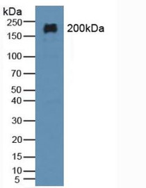 Western Blot; Sample: Rat Brain Tissue.